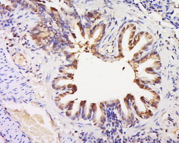 GPR92 Rabbit Polyclonal Antibo