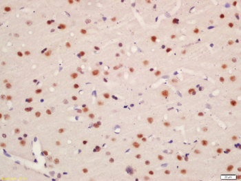 Phospho-TNIK (Ser764) Rabbit P