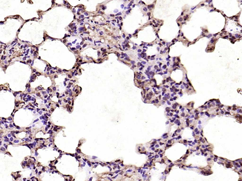 CDK6 Rabbit Polyclonal Antibod