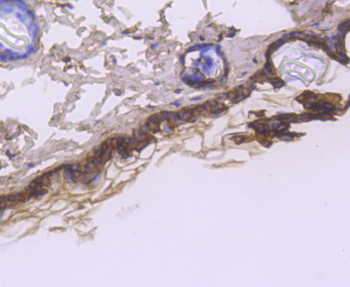 Cytokeratin 1 Recombinant Rabb