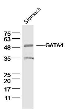 GATA4 Rabbit Polyclonal Antibo