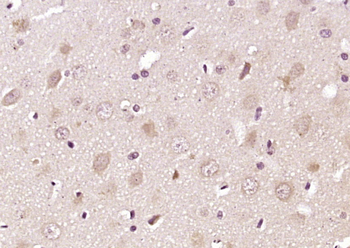 PIP5KL1 Rabbit Polyclonal Anti