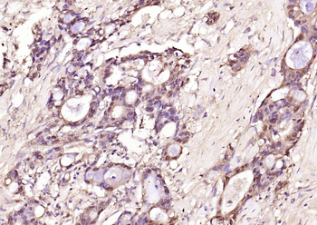 Galectin 3 Mouse Monoclonal An