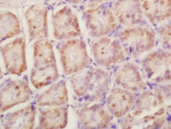 RPLP0 Rabbit Polyclonal Antibo