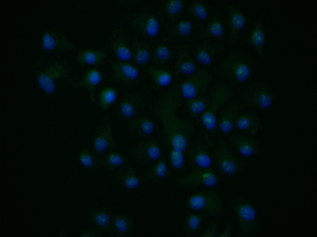 SGPL1 Rabbit Polyclonal Antibo