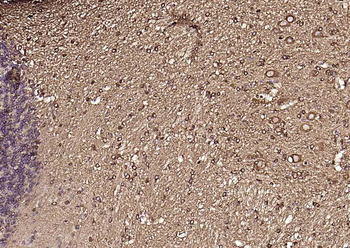 Tubulin beta-III Recombinant R