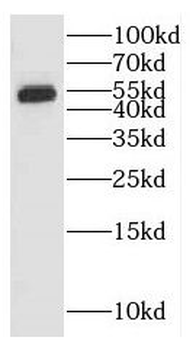 GALNS Antibody抗体，orb627219，bio