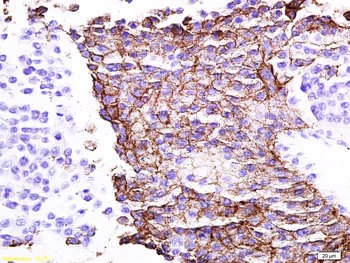 CCL18 Rabbit Polyclonal Antibo