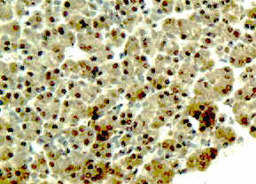 NT5C2 Rabbit Polyclonal Antibo