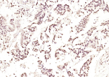 Phospho-Crkl (Tyr251) Rabbit P