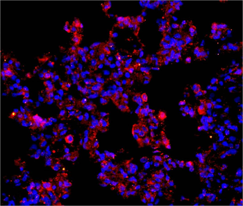 TRAF6 Rabbit Polyclonal Antibo