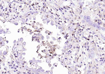 PD-L1 Recombinant Rabbit Monoc