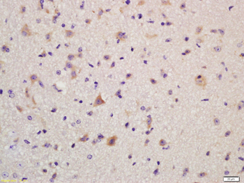 GLUR2 Rabbit Polyclonal Antibo