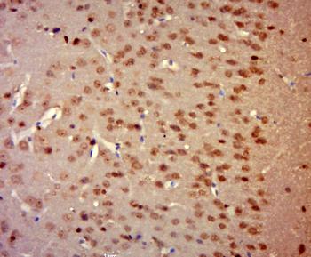 Phospho-Mcl1 (Ser159 + Thr163)