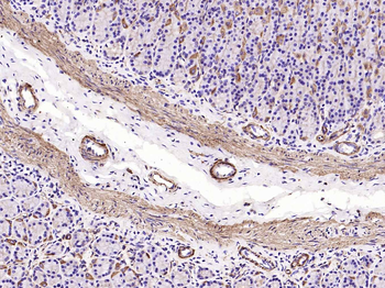 Alpha smooth muscle Actin Reco