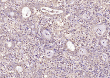 PPM1D Rabbit Polyclonal Antibo