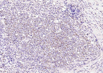 DIO2 Rabbit Polyclonal Antibod