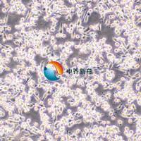  MEG-01-mCherry人成巨核细胞白血病细胞-红色标记