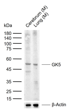 GK5 Rabbit Polyclonal Antibody