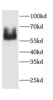 CAMK2G Antibody抗体，orb394833，bi