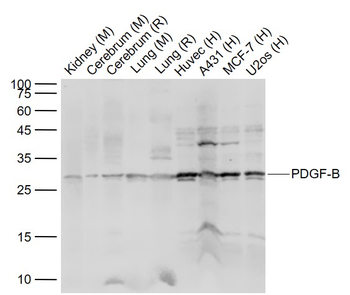 PDGF-B Rabbit Polyclonal Antib