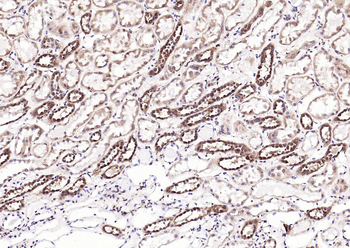 Calreticulin Mouse Monoclonal