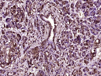 Galectin 3 Mouse Monoclonal An