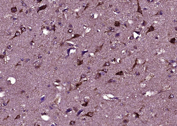 HEPACAM Rabbit Polyclonal Anti