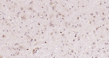 BARD1 Rabbit Polyclonal Antibo
