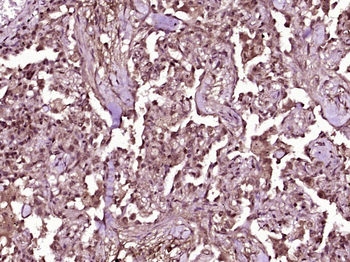 TBX5 Rabbit Polyclonal Antibod