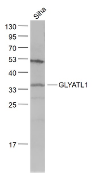 GLYATL1 Rabbit Polyclonal Anti