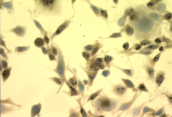 HSP70 Antibody (PerCP)抗体，orb14