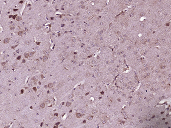 ACOX2 Rabbit Polyclonal Antibo