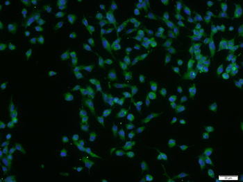 HRG beta 1 Rabbit Polyclonal A