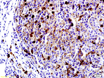 LRP1 Rabbit Polyclonal Antibod