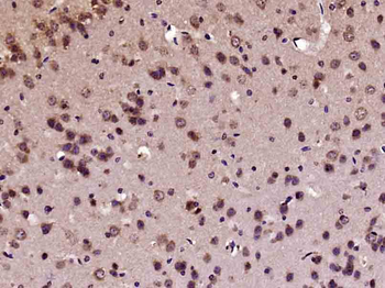 C-fos Rabbit Polyclonal Antibo