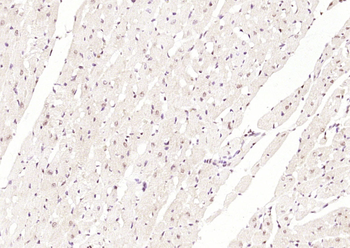 BNC1 Rabbit Polyclonal Antibod