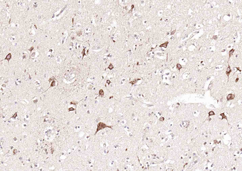 GDNFRA Rabbit Polyclonal Antib