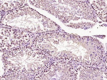 PER1 Rabbit Polyclonal Antibod