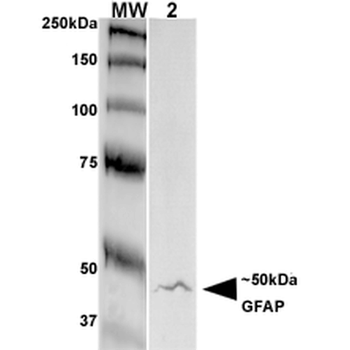 GFAP Antibody (RPE)抗体,orb15053
