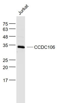 CCDC106 Rabbit Polyclonal Anti