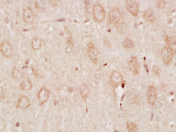 Phospho-RPS6KB1 (Ser427) Rabbi