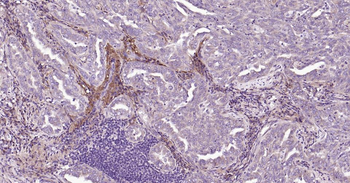 MMP12 Rabbit Polyclonal Antibo