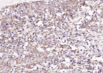 CDKN3 Rabbit Polyclonal Antibo