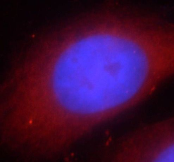 RIPK1 Antibody抗体，orb395522，bio