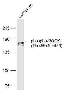 Phospho-ROCK1 (Thr455+Ser456) 