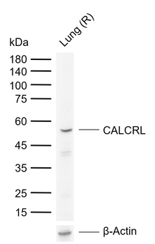 CALCRL Rabbit Polyclonal Antib