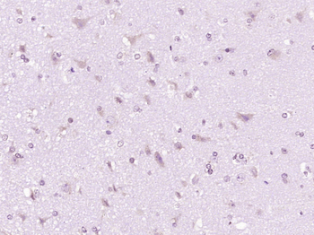 Phospho-PDGFRA (Tyr849)/ PDGFR