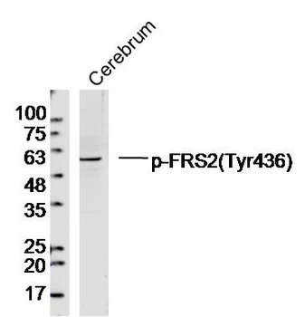 Phospho-FRS2 (Tyr436) Rabbit P