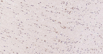 MMP12 Rabbit Polyclonal Antibo